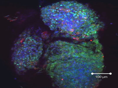 Cellules souches et médecine régénérative